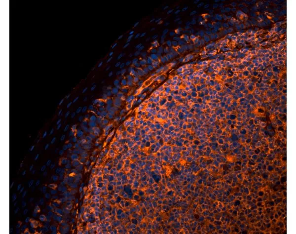 Sambucus Nigra Lectin (SNA, EBL), CY3 | Vector Labs