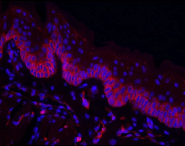 Griffonia Simplicifolia Lectin I (GSL I) Isolectin B4