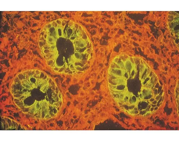 Lycopersicon Esculentum (Tomato) Lectin (LEL, TL), Fluorescein