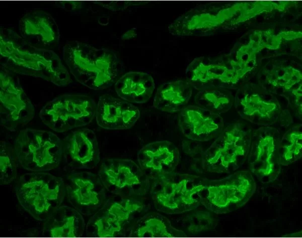 Aleuria Aurantia Lectin (AAL), Fluorescein | Vector Labs