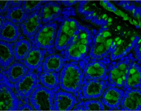 Aleuria Aurantia Lectin (AAL), Fluorescein 3 0723121dfldapimods 3 jpg