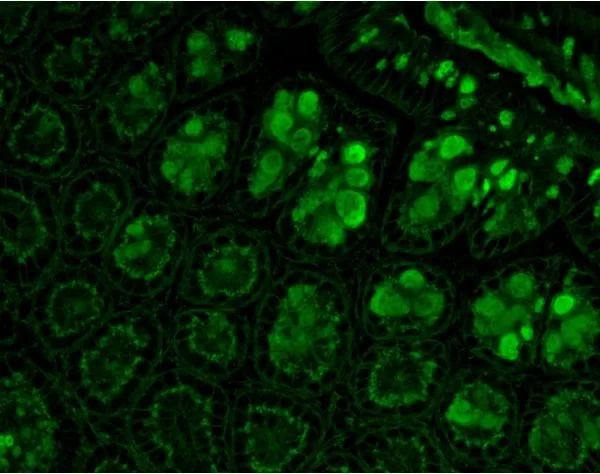 Aleuria Aurantia Lectin (AAL), Fluorescein 4 0723121dflmods 3 jpg