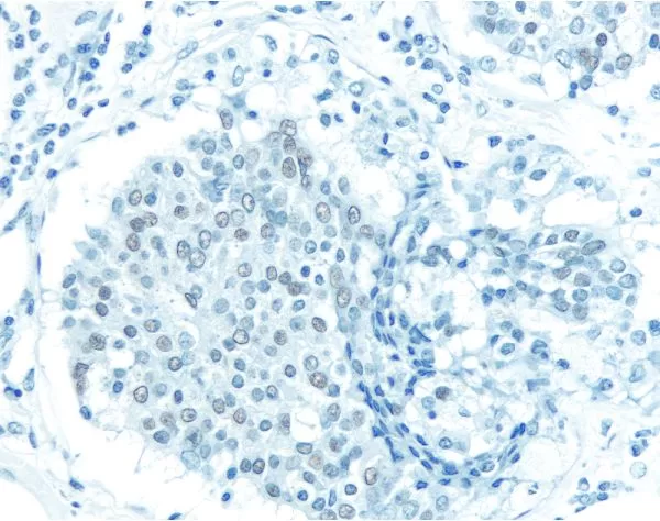 Antigen Unmasking Solution, Citric Acid Based | Vector Labs