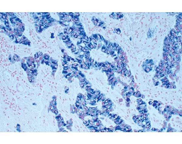 Nuclear Fast Red Counterstain