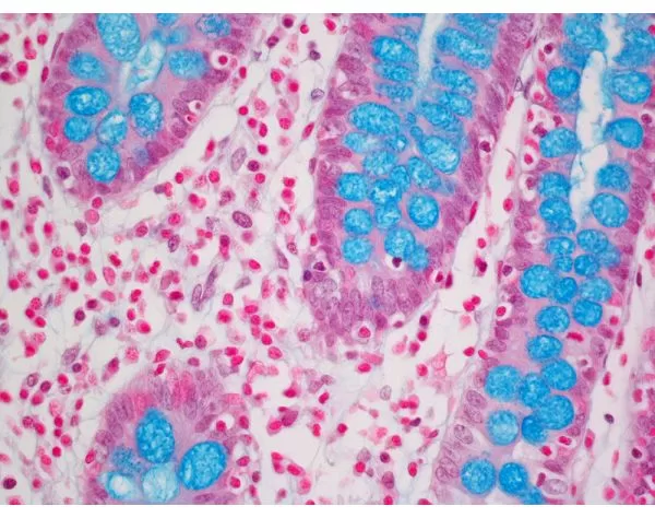 Alcian Blue (pH 2.5) Stain Kit