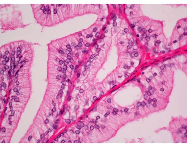 Hematoxylin & Eosin Stain Kit