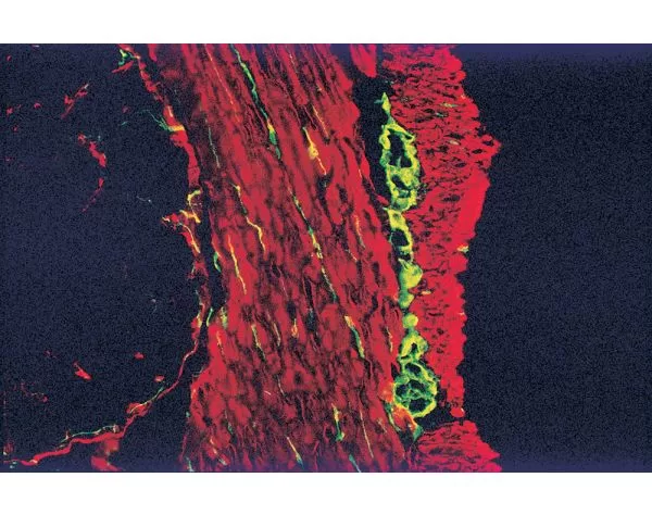M.O.M. (Mouse On Mouse) Blocking Reagent | Vector Labs