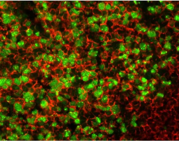 M.O.M. (Mouse On Mouse) Blocking Reagent | Vector Labs