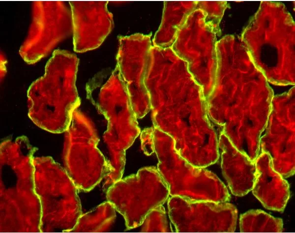 M.O.M. (Mouse On Mouse) Blocking Reagent | Vector Labs