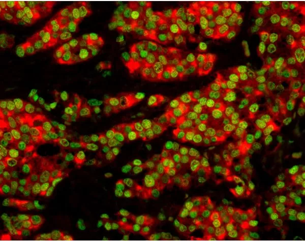 M.O.M. (Mouse On Mouse) Blocking Reagent | Vector Labs