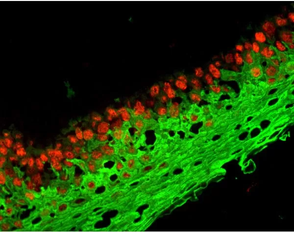 M.O.M. (Mouse On Mouse) Blocking Reagent | Vector Labs