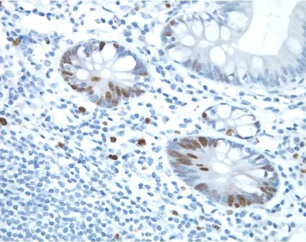 ImmPRESS HRP Horse Anti-Rabbit IgG Polymer Detection Kit