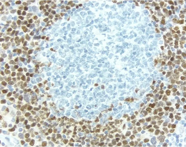 ImmPRESS HRP Horse Anti-Rabbit IgG Polymer Detection Kit