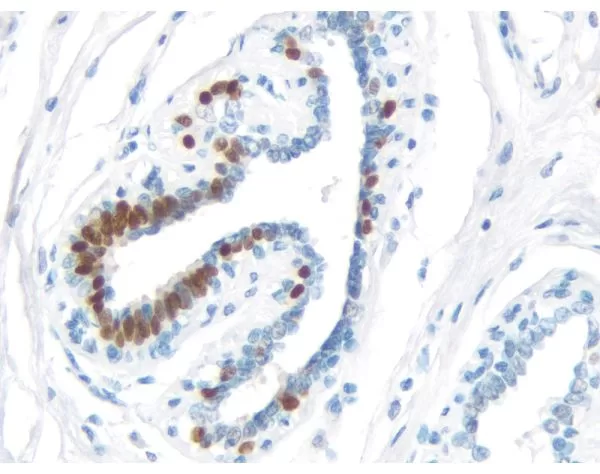 ImmPRESS HRP Universal Antibody (Horse Anti-Mouse/Rabbit IgG) Polymer Detection Kit, Peroxidase