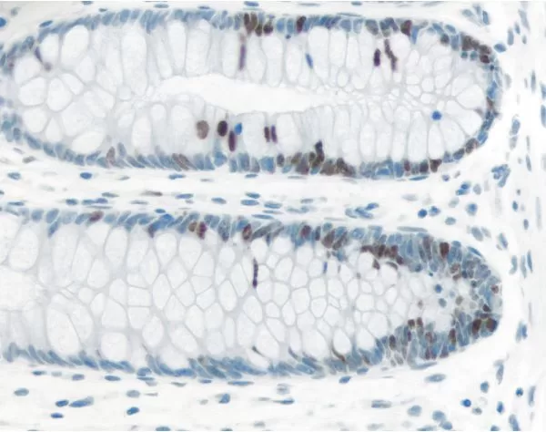 ImmPRESS Excel Amplified Polymer Staining Kit, Anti-Rabbit IgG, Peroxidase 2 immpress.excel2 1 1 jpg