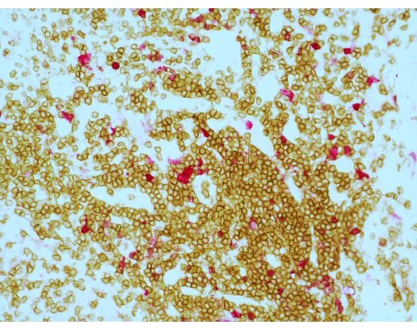 ImmPRESS Duet Double Staining HRP/AP Polymer Kit (Anti-Mouse IgG-brown, Anti-Rabbit IgG-magenta) 2 080416erikasxn21 1000 1 jpg