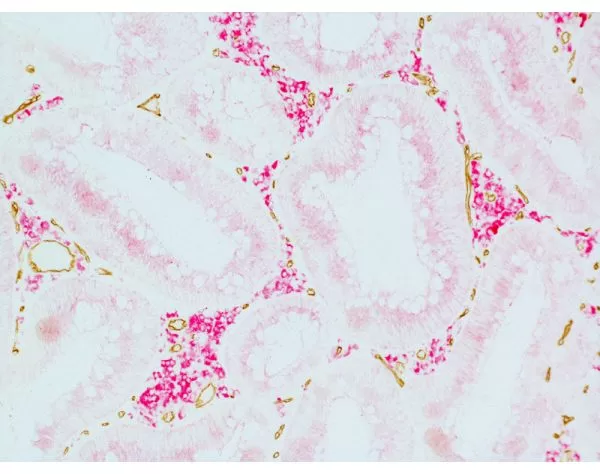 ImmPRESS Duet Double Staining HRP/AP Polymer Kit (Anti-Mouse IgG