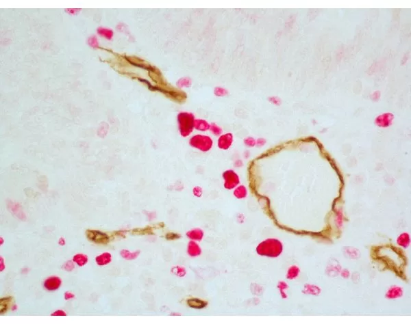 ImmPRESS Duet Double Staining HRP/AP Polymer Kit (Anti-Mouse IgG-brown, Anti-Rabbit IgG-magenta) 4 081116erikasxn14 1000 1 jpg