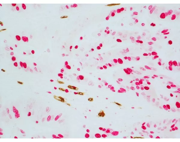 ImmPRESS Duet Double Staining HRP/AP Polymer Kit (Anti-Mouse IgG-brown, Anti-Rabbit IgG-magenta) 5 081116erikasxn14b 1000 1 jpg