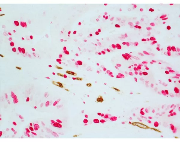 ImmPRESS Duet Double Staining HRP/AP Polymer Kit (Anti-Mouse IgG