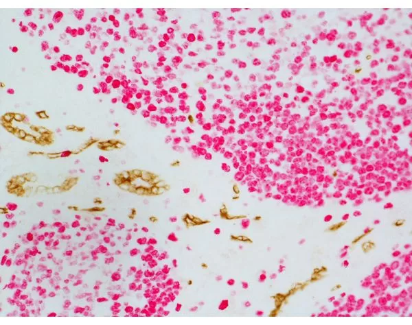 ImmPRESS Duet Double Staining HRP/AP Polymer Kit (Anti-Mouse IgG-brown, Anti-Rabbit IgG-magenta) 7 081116erikasxn21 1000 1 jpg