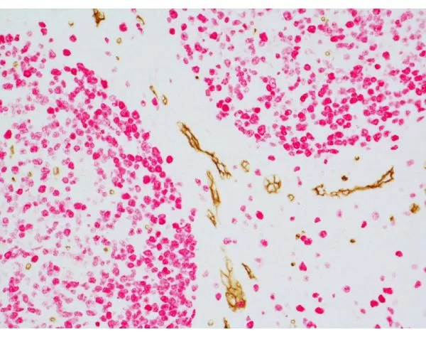 ImmPRESS Duet Double Staining HRP/AP Polymer Kit (Anti-Mouse IgG-brown, Anti-Rabbit IgG-magenta) 8 081116erikasxn21b20x 1000 1 jpg
