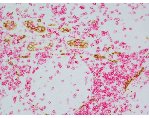 ImmPRESS Duet Double Staining HRP/AP Polymer Kit (Anti-Mouse IgG
