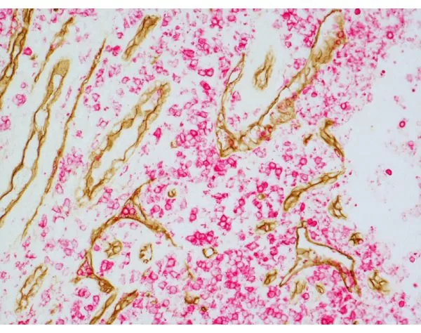 ImmPRESS Duet Double Staining HRP/AP Polymer Kit (Anti-Mouse IgG