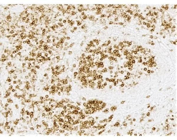 ImmPRESS HRP Horse Anti-Rabbit IgG PLUS Polymer Kit, Peroxidase