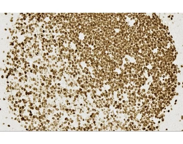 ImmPRESS HRP Horse Anti-Mouse IgG PLUS Polymer Kit, Peroxidase