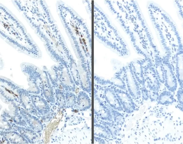 M.O.M. (Mouse on Mouse) ImmPRESS Polymer Reagent, Anti-Mouse IgG, Peroxidase