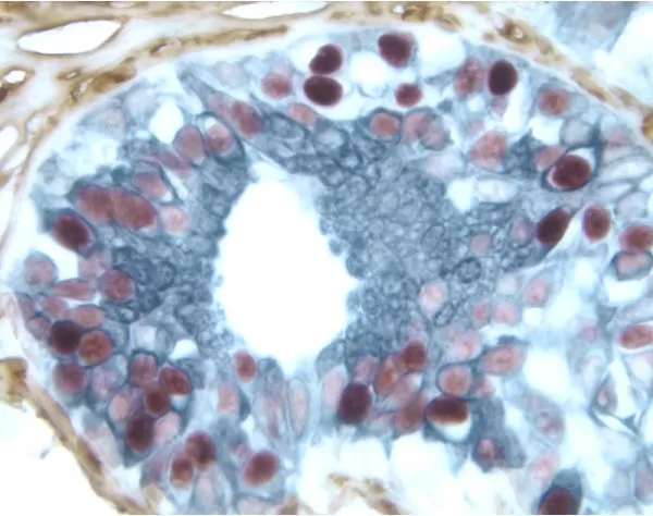 ALPHA THETA-C / アルファシータC AT-6100 VECTASTAIN® Elite ABC-HRP Kit, Peroxidase (Standard) | Vector Labs