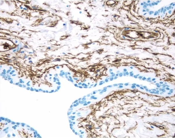 VECTASTAIN® Elite ABC-HRP Kit, Peroxidase (Mouse IgG