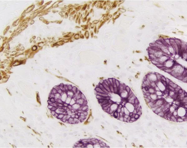 VECTASTAIN® Elite ABC-HRP Kit, Peroxidase (Mouse IgG