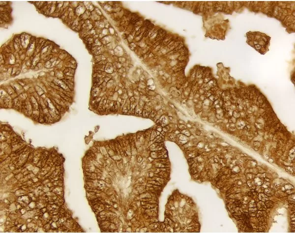 ImmPACT® DAB Substrate, Peroxidase (HRP) | Vector Labs