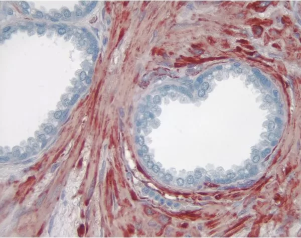 AEC Substrate Kit, Peroxidase (HRP), (3-amino-9-ethylcarbazole