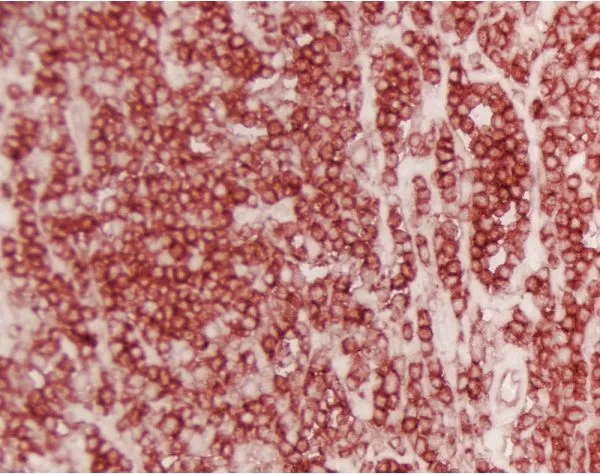 ポスター s.s ImmPACT® AMEC Red Substrate, Peroxidase (HRP) | Vector Labs