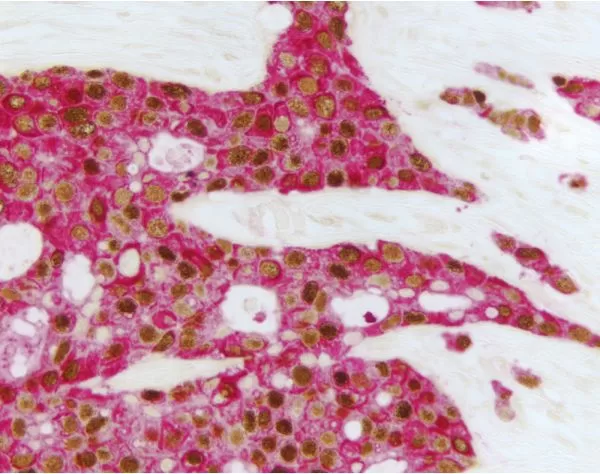 Vector Red Substrate Kit, Alkaline Phosphatase (AP) 13 mlbpg11 4 14 jpg