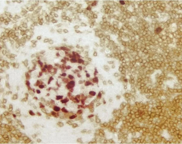 Vector Red Substrate Kit, Alkaline Phosphatase (AP) 14 mlbpg12 4 14 jpg