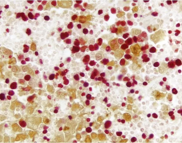 Vector Red Substrate Kit, Alkaline Phosphatase (AP) 9 mlbpg2 4 14 jpg