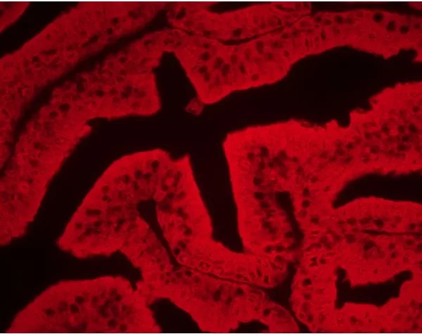 ImmPACT Vector Red Substrate, Alkaline Phosphatase (AP) | Vector Labs