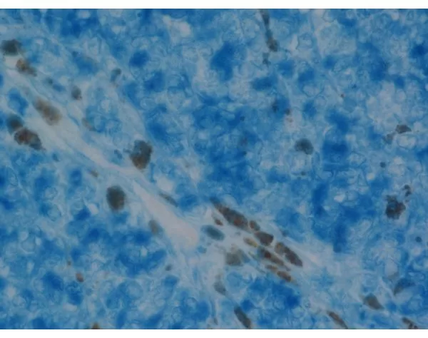 Vector Blue Substrate Kit, Alkaline Phosphatase (AP) | Vector Labs