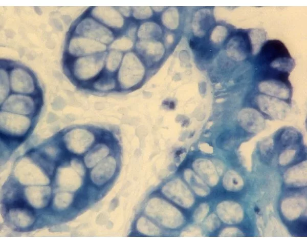 BCIP/NBT Substrate Kit, Alkaline Phosphatase (AP), (5-bromo-4