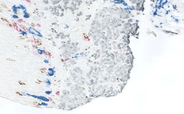 VectaPlex™ Antibody Removal Kit 2 vectaplex 2