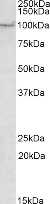Goat Anti-AAK1 Antibody