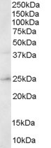 Goat Anti-ABAD / HADH2 Antibody