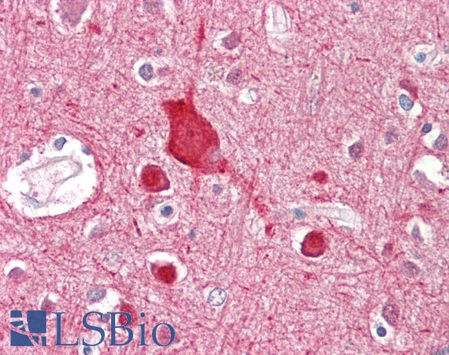 Goat Anti-ABCA2 Antibody