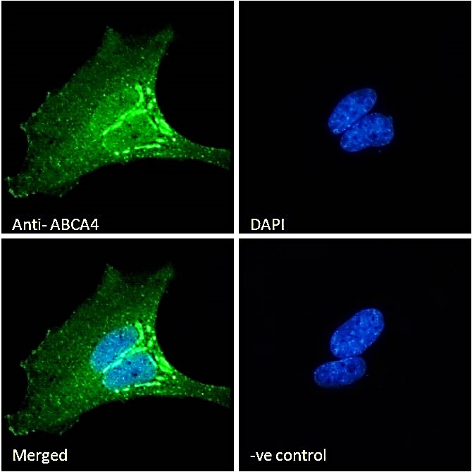 Goat Anti-ABCA4 Antibody