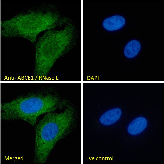 Goat Anti-ABCE1 / RNase L Antibody