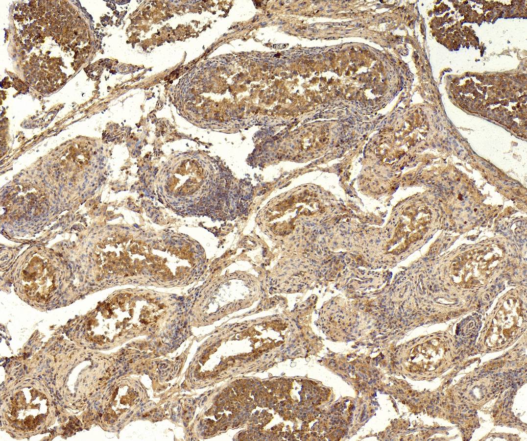 Goat Anti-ABCG1 Antibody